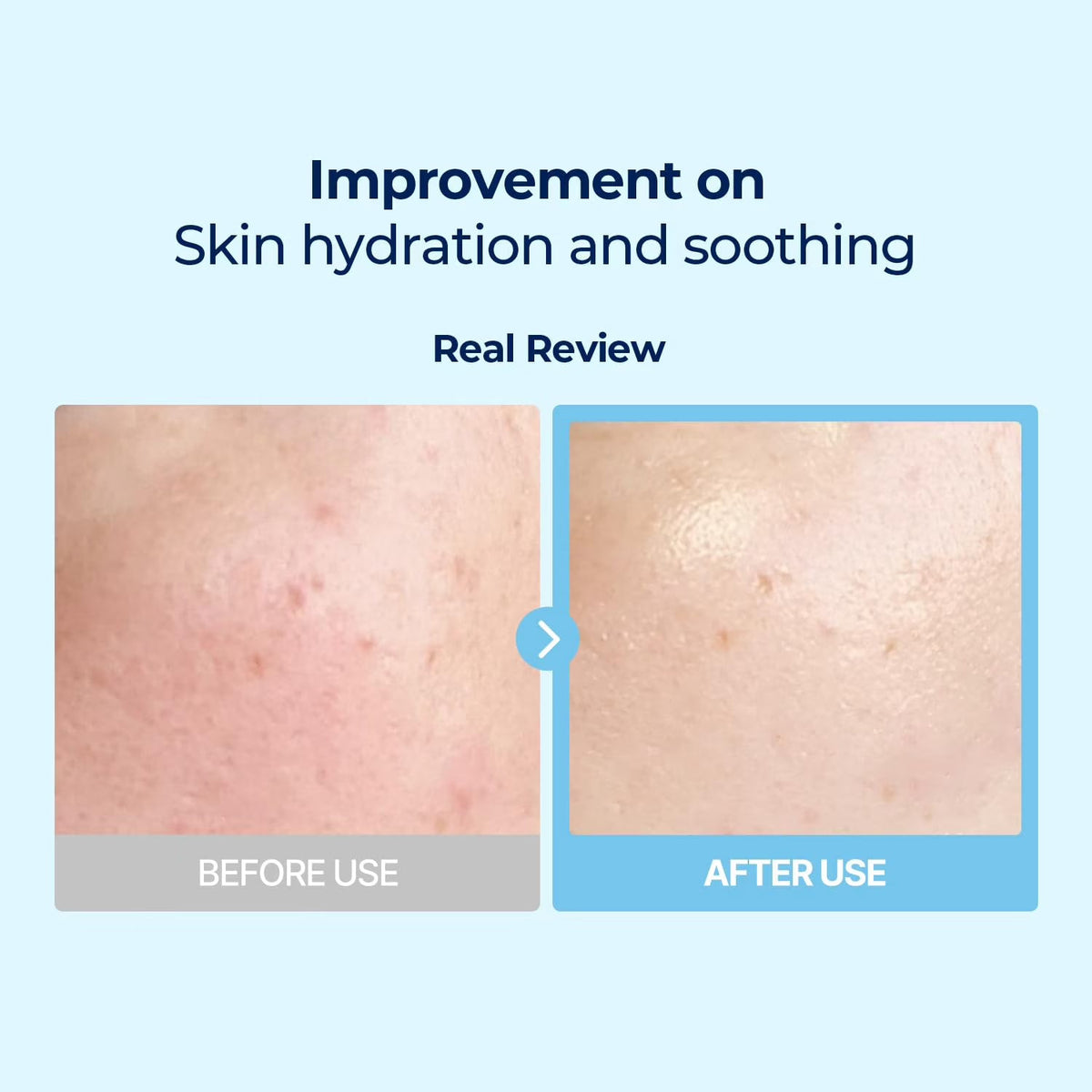 Torriden Dive-In Low Molecular Hyaluronic Acid Mask Pack